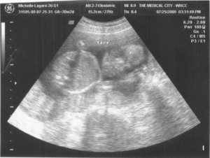 ultrasound2